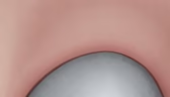 Close Up