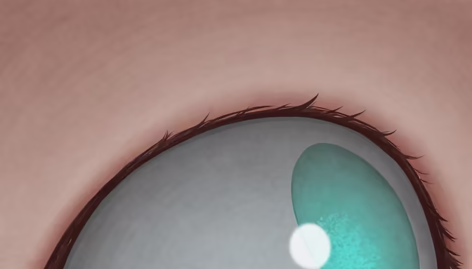 Eye See You
