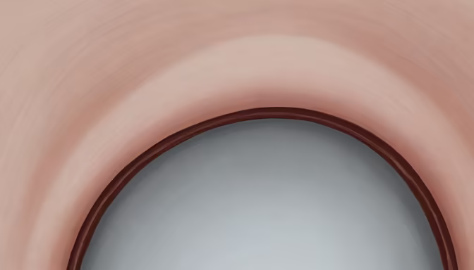 Abstract Portal