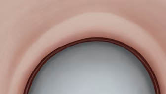 Abstract Portal Abstract Portal