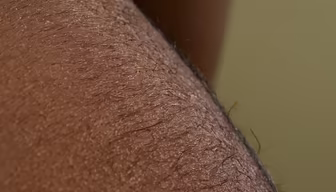 Skin Close-Up