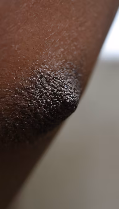 Elbow Close-Up Elbow Close-Up