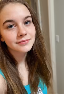 Fresh Faced Fresh Faced