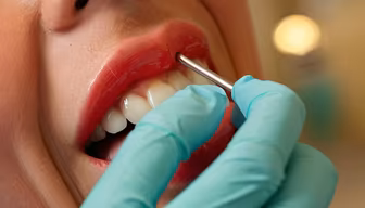Dental Checkup Dental Checkup