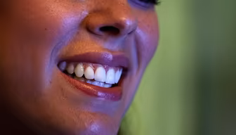 Radiant Smile Radiant Smile