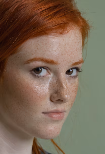 Freckled Beauty