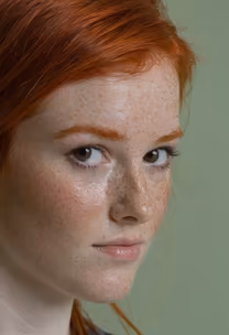 Freckled Beauty Freckled Beauty